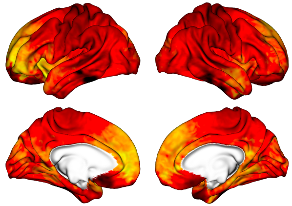 The image above shows a snapshot of cortical activity in a human brain. Upper and lower panels display distinct views for each hemisphere. The plot was generated by PhD student Zhiling Gu using R package “ciftiTools” based on data from the Motor task study of the HCP 500-subject data release. 